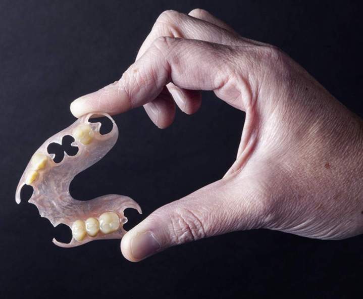 Fabrication de prothèse dentaire Normandie