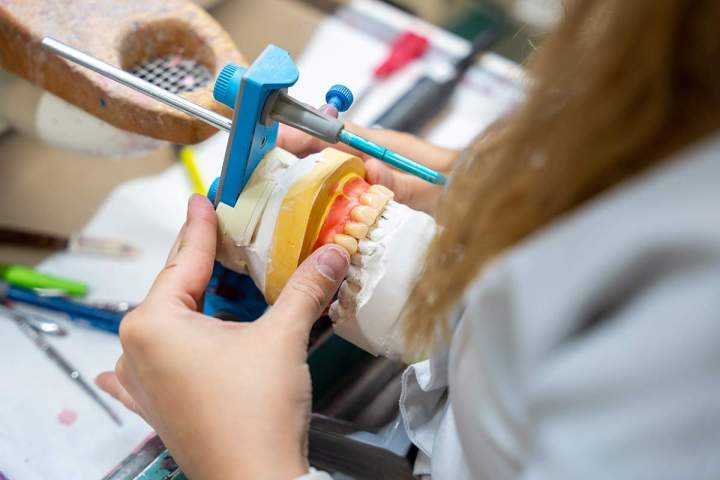 Conception de prothèses amovibles de qualité