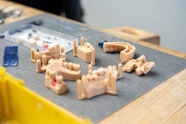 Conception de prothèses par ordinateur Normandie