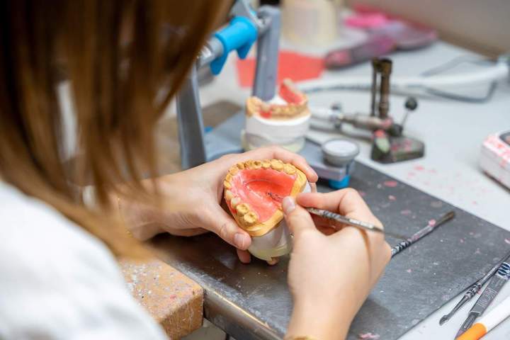 Création de dispositifs dentaires sur implant