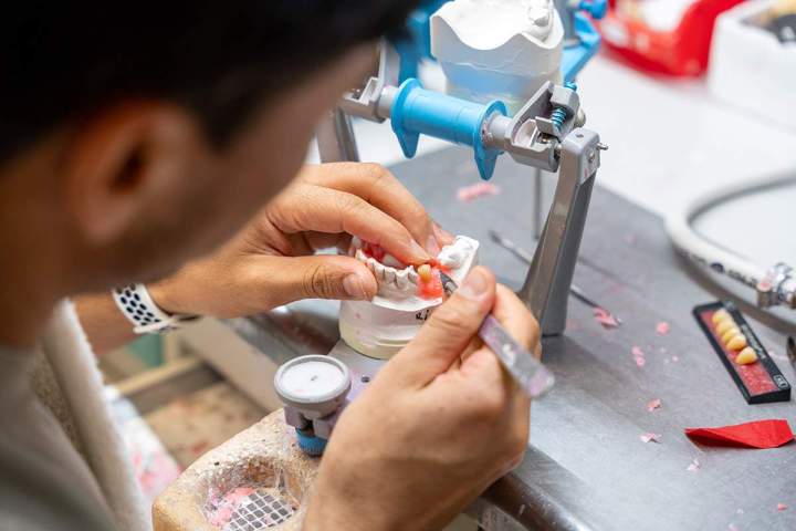 Fabricant de prothèse sur implant dentaire Normandie