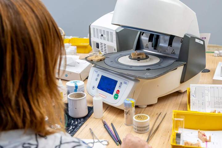 Laboratoire de prothèses dentaires All on 4 Normandie