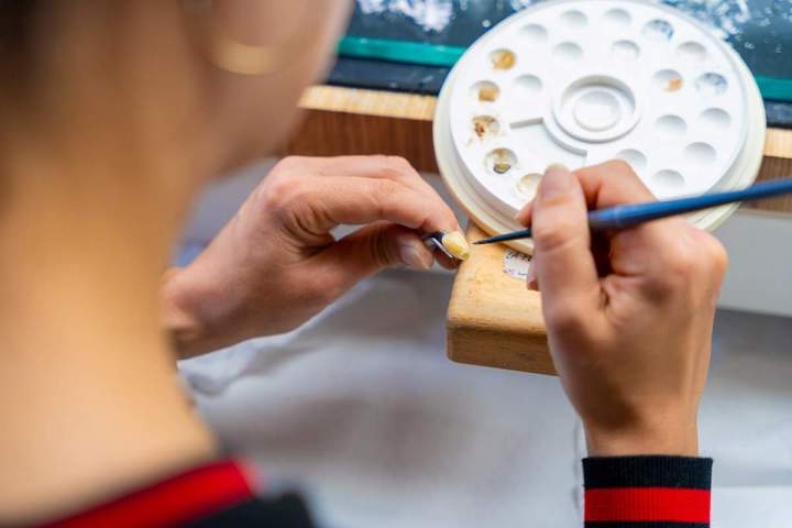 Fabrication de prothèse dentaire Normandie