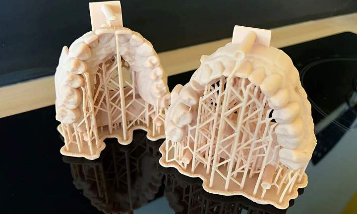 Spécialiste en prothèses All on 4 en Normandie