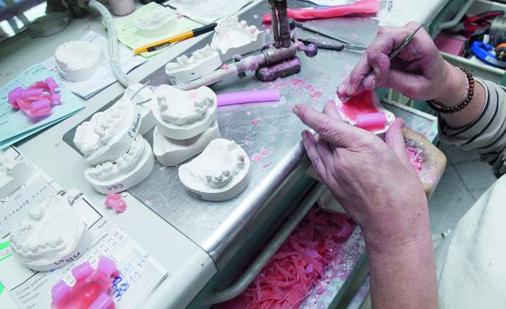 Fabrication prothèse All on 4, Évreux